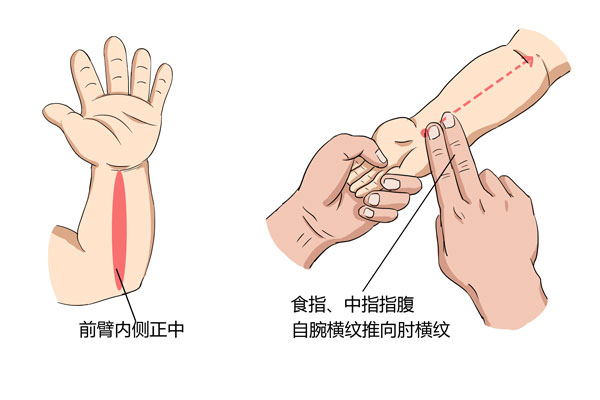 孩子发烧怎么推拿退烧