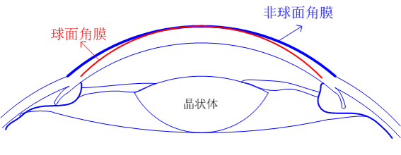 王曌博士一种具有非球面基弧设计的角膜塑形镜