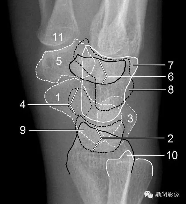 x线高清图谱精致腕关节解剖