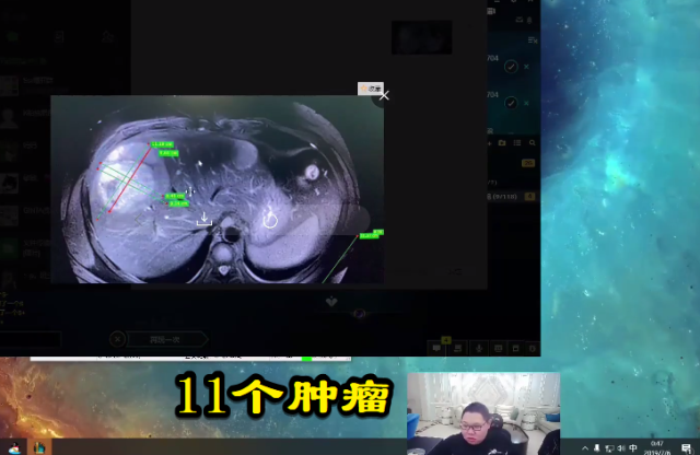 pdd女装来袭三个月后减肥失败还要捐500万