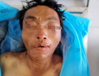 认尸启事昨天在砚山夜色ktv岔路路段交通事故死亡一人