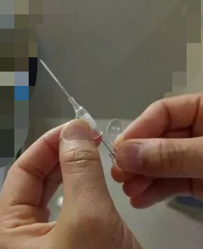 效果:重新调整留置针后,采用最佳持针方式,固定好,持针稳,利于穿刺