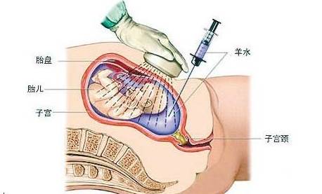 孕期流程|孕妈或准备要宝宝的妈妈快点收藏起来吧!