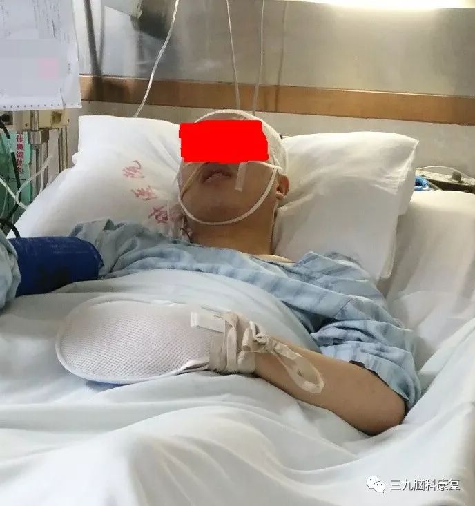 多学科协作促进脑损伤患者的早期康复
