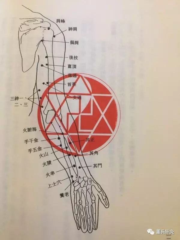 董氏针灸培训班课堂案例分享之手五金手千金穴