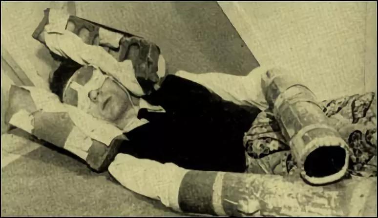 虚构的怪奇物语,真实的残酷人体实验_苏联