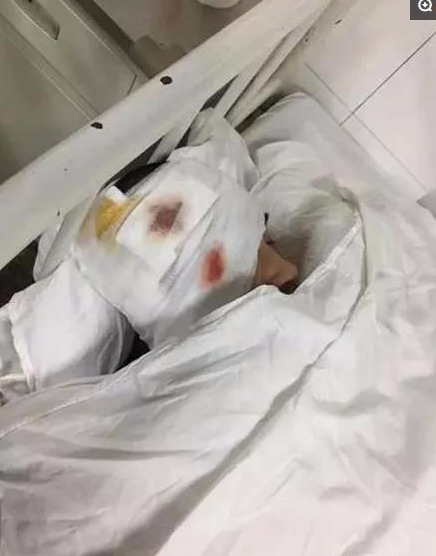 又一男明星发生车祸严重程度跟当初胡歌如出一辙愿他早日恢复