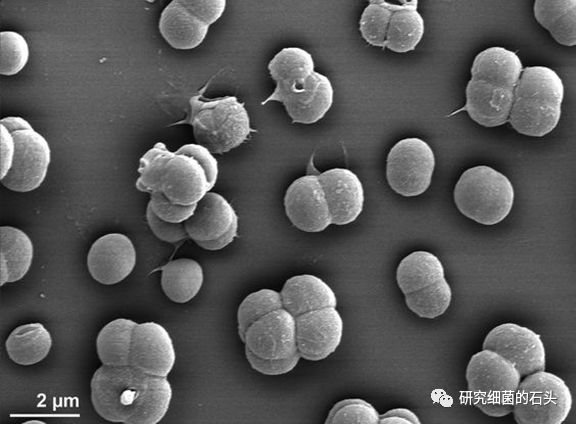 褐球固氮菌显微镜图片图片
