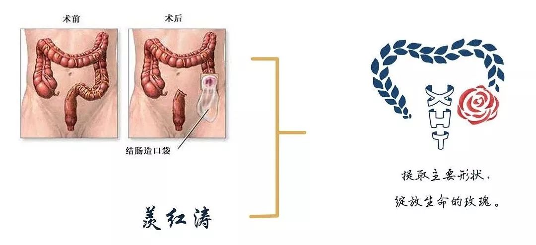 羡红涛造口护理工作室有logo了