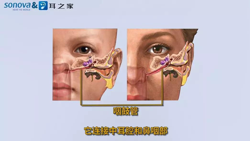 咽鼓管功能障碍这个时候,就会产生耳朵闷闷的,听力下降的感觉.
