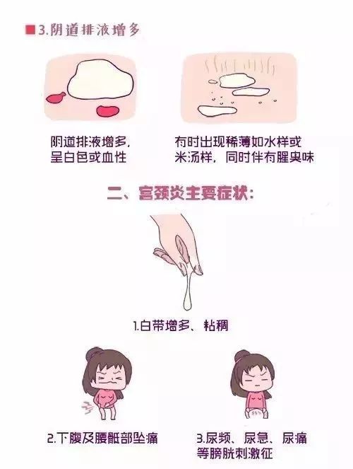其实宫颈炎症并非难治之症,只是因它早期的症状并不明显,易被忽略