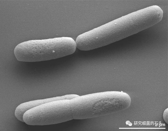 收藏56张图片带您认识细菌长啥样