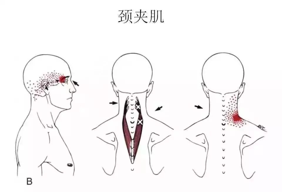 頭頸這些肌肉不好會影響說話吞嚥