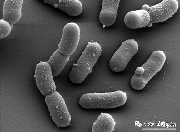 收藏56張圖片帶您認識細菌長啥樣