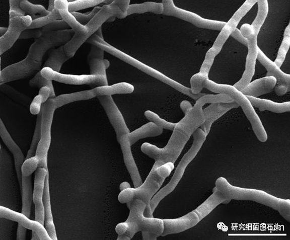 收藏|56張圖片帶您認識細菌長啥樣?_球菌