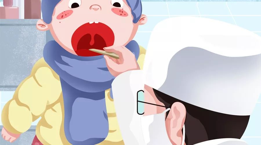 喉镜检查可见,囊肿位于会厌舌面,大者充满整个会厌谷.