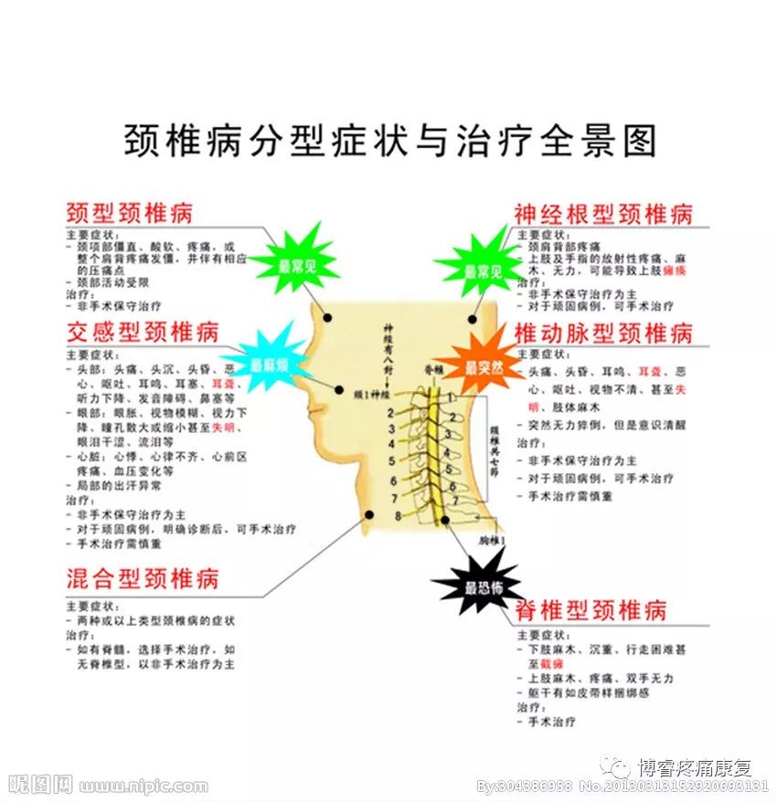 椎动脉型颈椎病的治疗