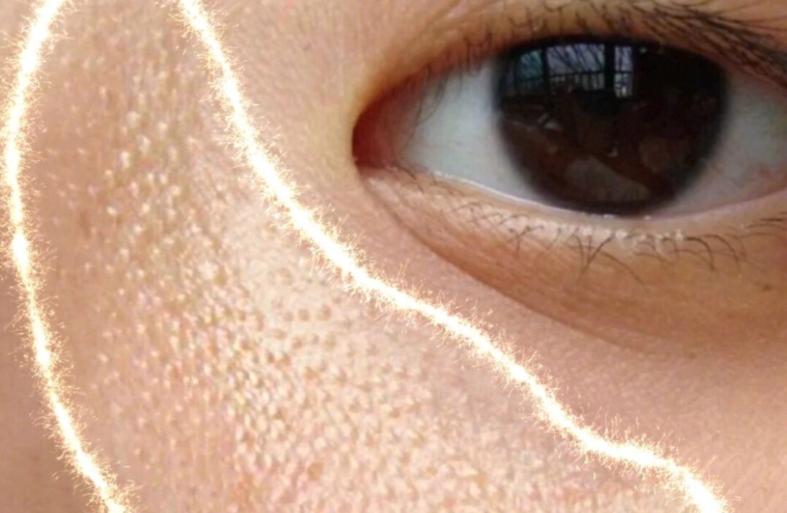 鸡皮肤出现白米粒(鸡皮肤出现白米粒疙瘩) 鸡皮肤出现白米粒(鸡皮肤出现白米粒疙瘩)