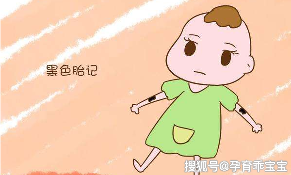 胎记颜色有什么意义?解析宝宝常见几种胎记,父母要早了解