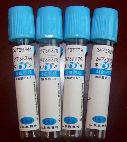 新项目 狼疮抗凝物质检测(la)