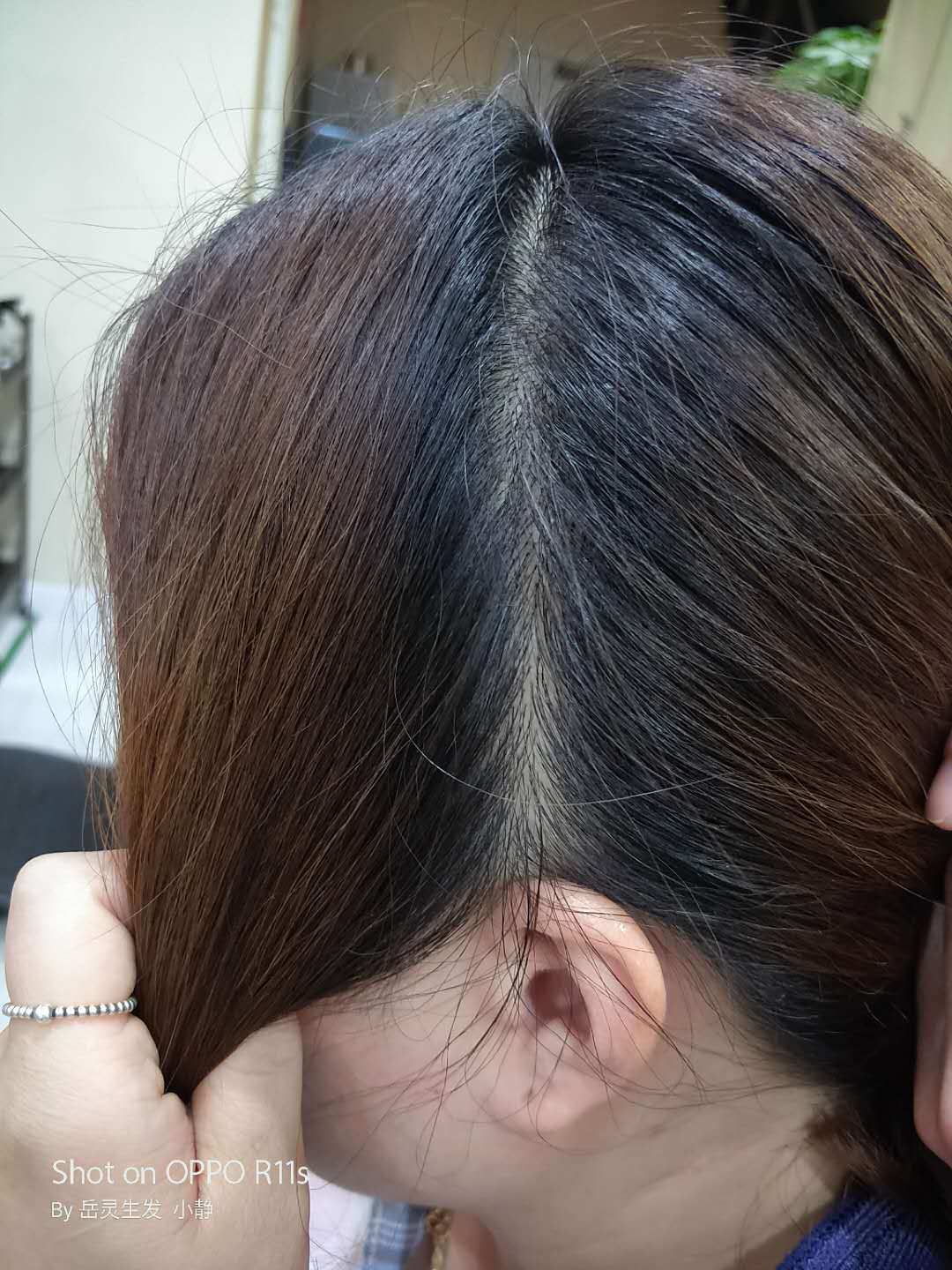 岳灵生发之家的个人展示页