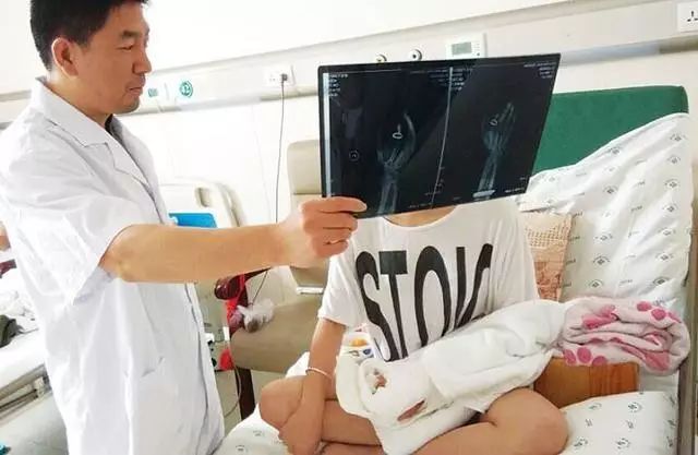 便将手伸进洗衣机里,导致中指骨头被齐根绞断