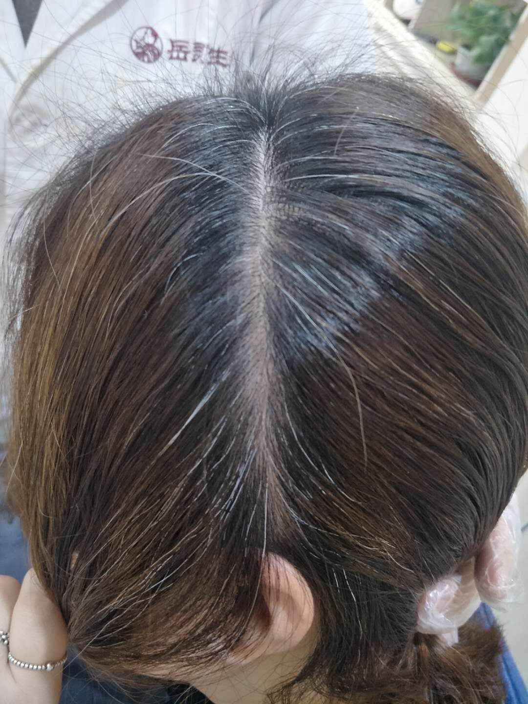 岳灵生发之家的个人展示页