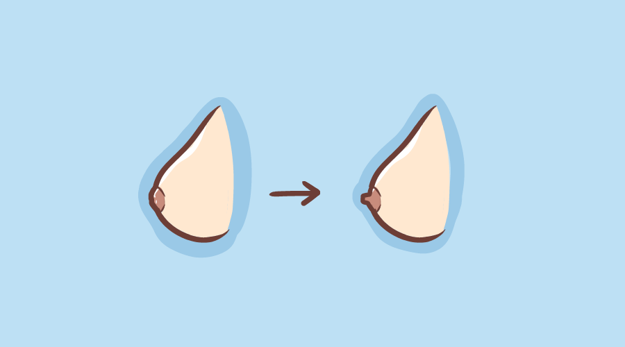 孕妈必备乳房护理技巧,你get了吗?_乳头