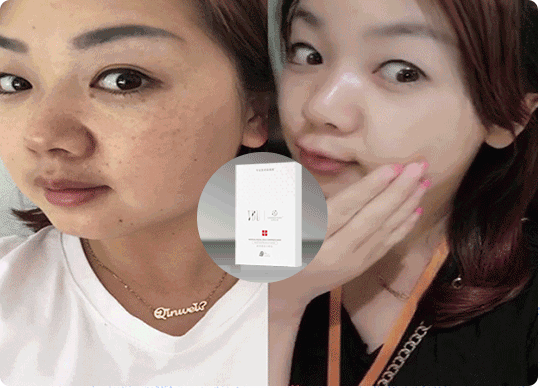 如果你脸上有"斑",这个新方法将让你惊喜到尖叫!