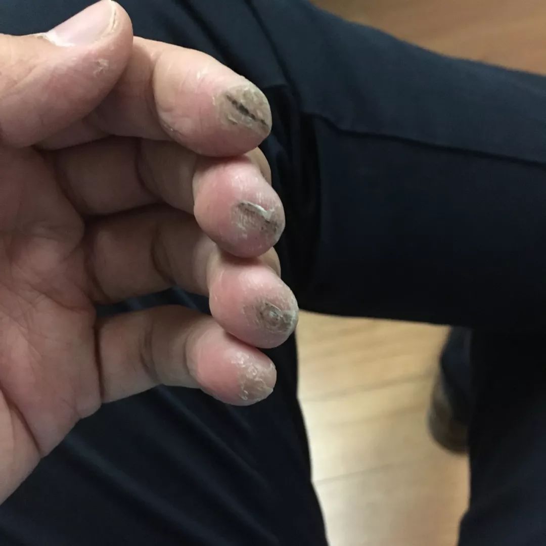 伟大的背后都是苦难-演奏家的手,芭蕾舞演员的脚_乐器