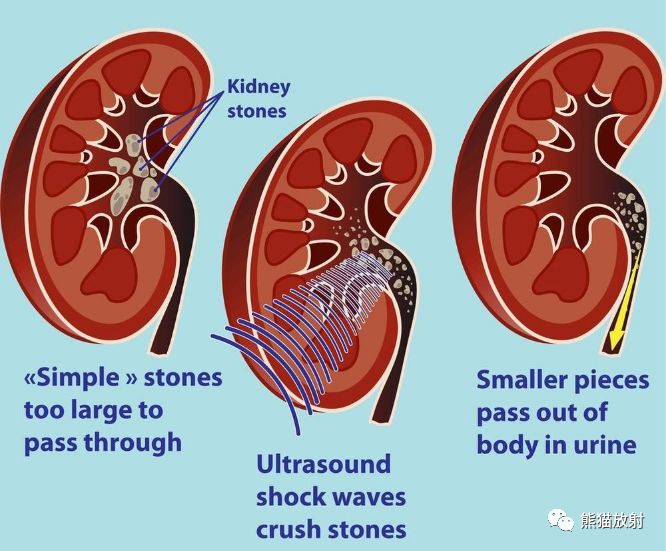 精彩解剖丨腎臟輸尿管膀胱腎上腺前列腺