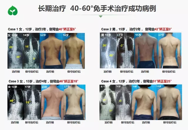 “奋进新时代·开创新未来”走进广东大湾区新苗基金公益项目谱写新篇章 “奋进新时代·开创新未来”走进广东大湾区新苗基金公益项目谱写新篇章