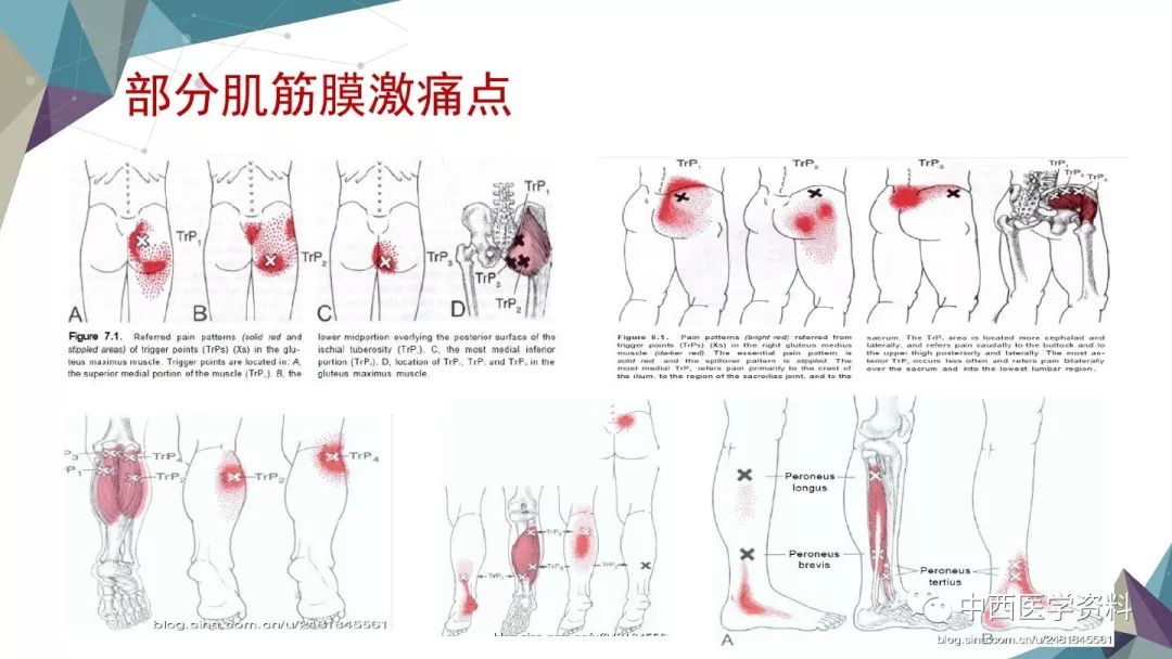 半膜肌疼痛图片