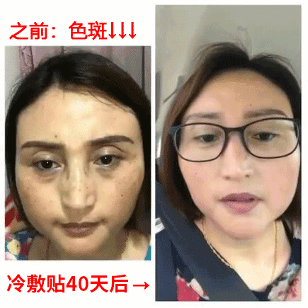 如果你脸上有"斑",这个新方法将让你惊喜到尖叫!