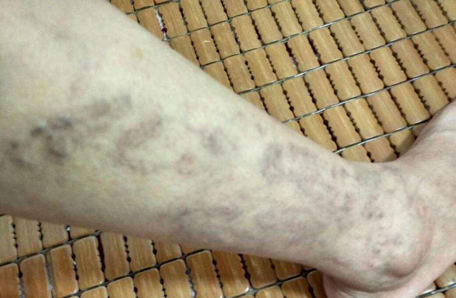 特别是用生姜或辣椒煎水洗脚,可较快地扩张人体呼吸道粘膜的毛细血管