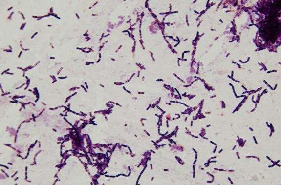 枯草芽孢杆菌电镜图片