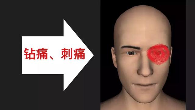 相较于前两种类型,三叉神经自主神经性头痛发病率较低.