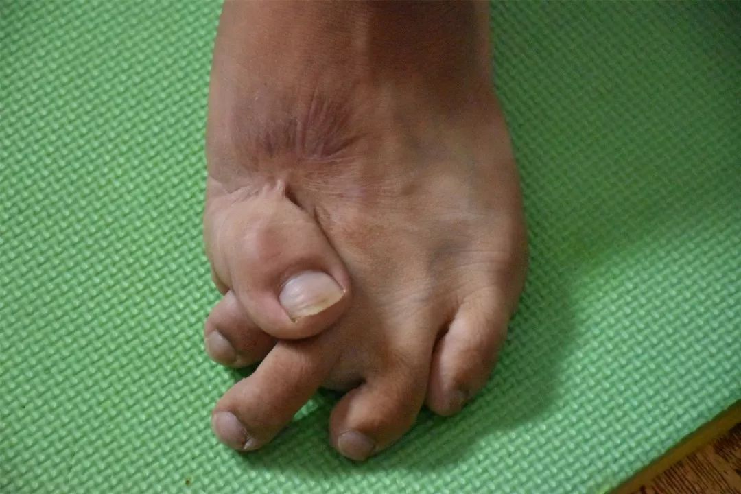 下冯庄村的90后无臂天才张成成