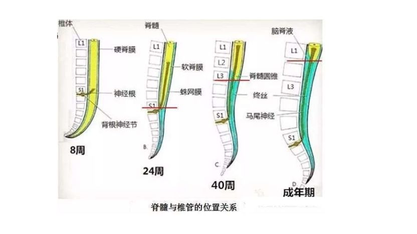 讀書報告會六十內容脊髓栓系綜合徵患者椎管內麻醉致神經損傷一例