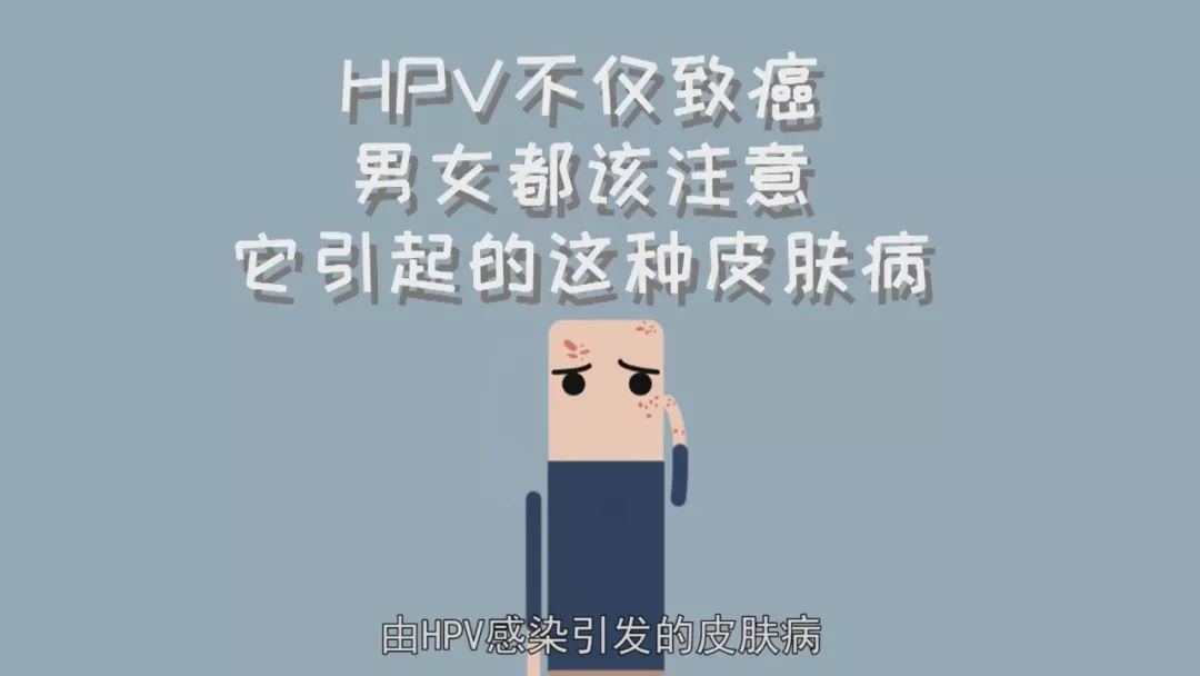 hpv不僅致癌,男女都該注意它引起的這種皮膚病