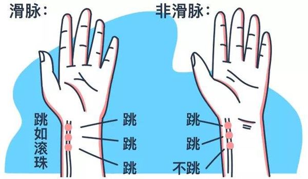 辨别八种重要脉象看完这篇就可以了