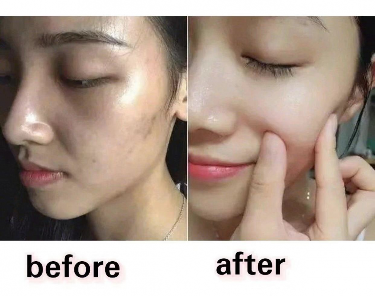 成为氧气美女的必杀技_皮肤