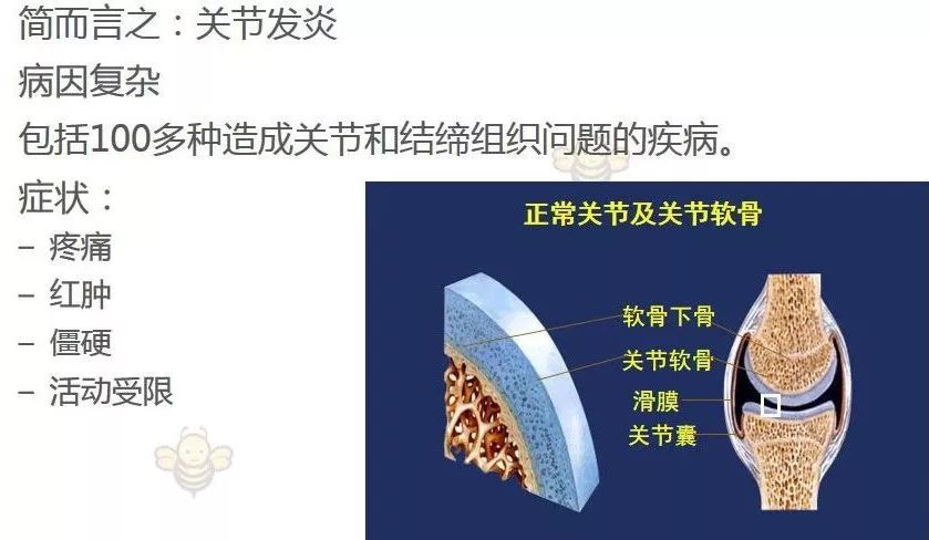 一文读懂风湿病相关关节炎
