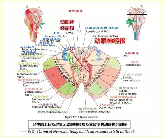 下丘層面:滑車神經核(發出纖維構成滑車神經).