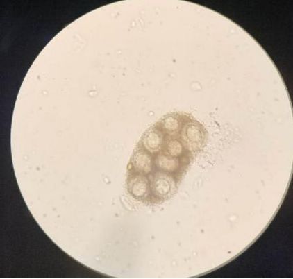 细粒棘球绦虫虫卵图片图片