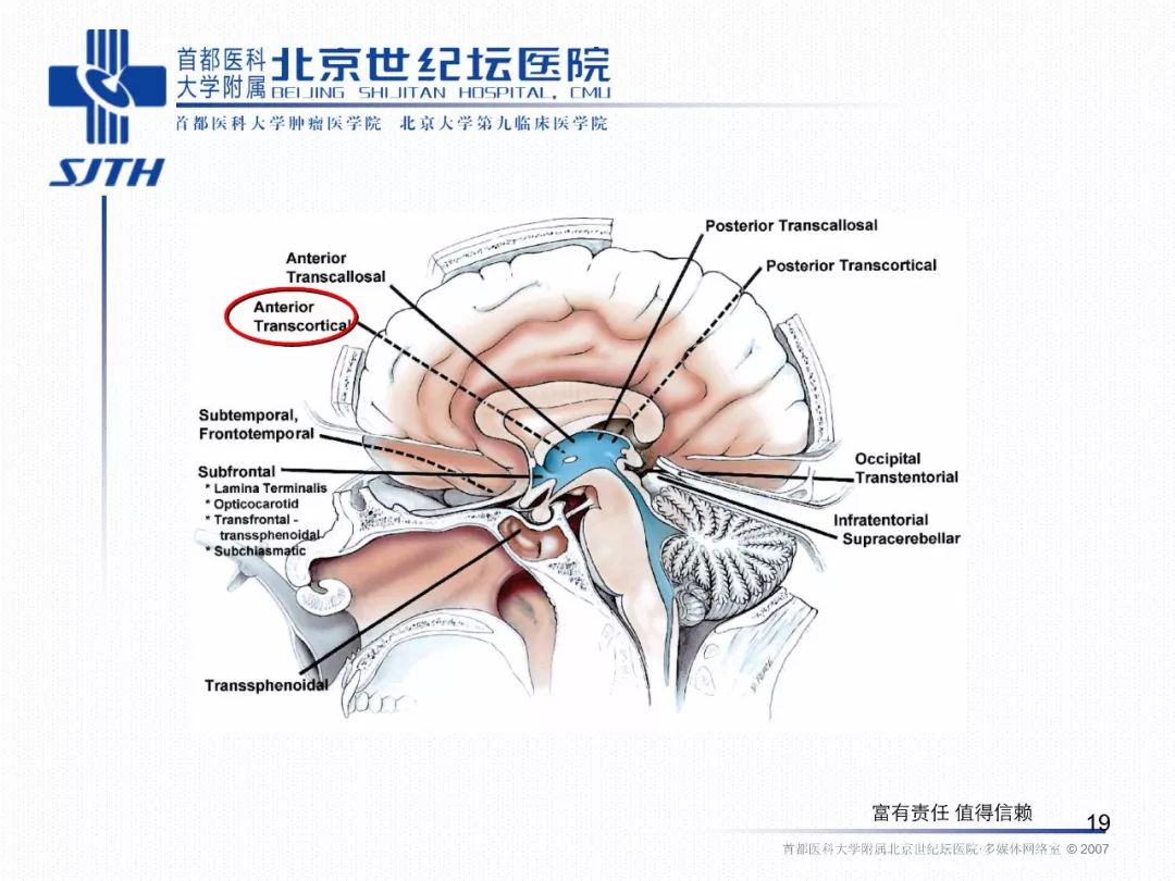 神经内镜storz图片