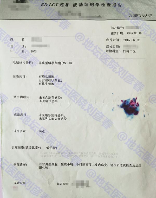 「病例分享」曾两度被确诊为宫颈癌,她是如何未经手术而痊愈的?