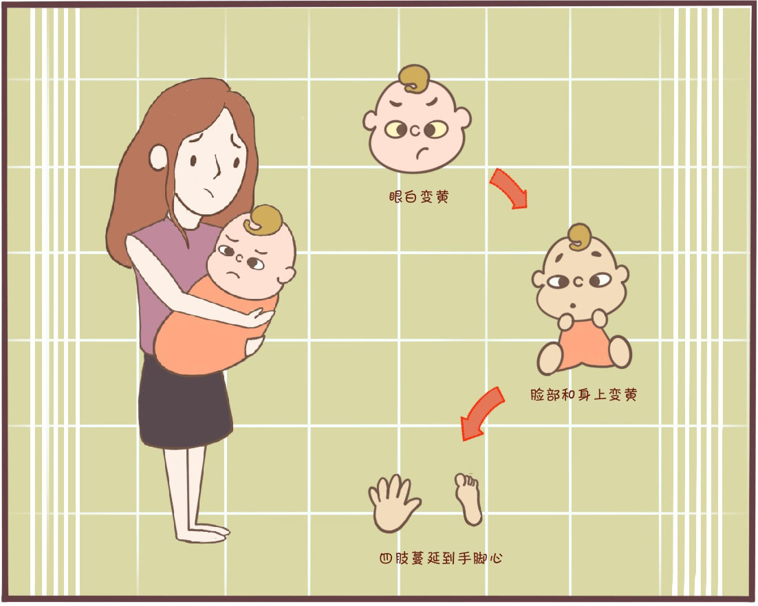 晒太阳就能去黄疸快速祛除新生儿黄疸的方法了解一下