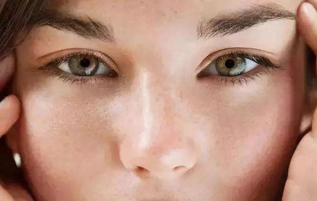 干皮变油皮怎么回事?