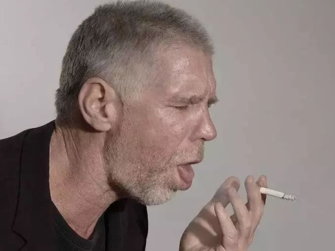 如尼古丁,烟焦油,一氧化碳等 抽烟不仅会出现 咳嗽,多痰,口臭, 牙斑